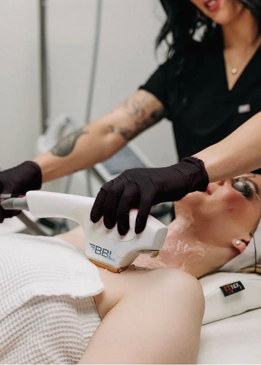 BBL Photofacial by Beauty Culture MedSpa at Beauty Culture MedSpa