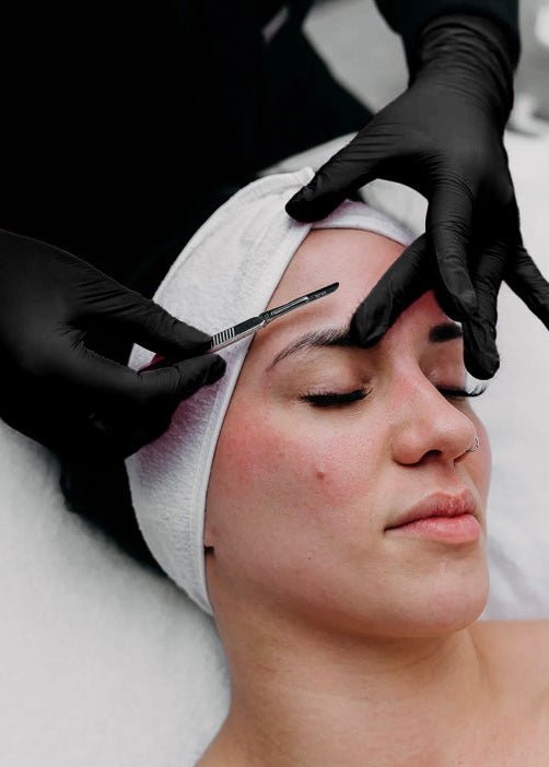 Dermaplaning by Beauty Culture MedSpa at Beauty Culture MedSpa