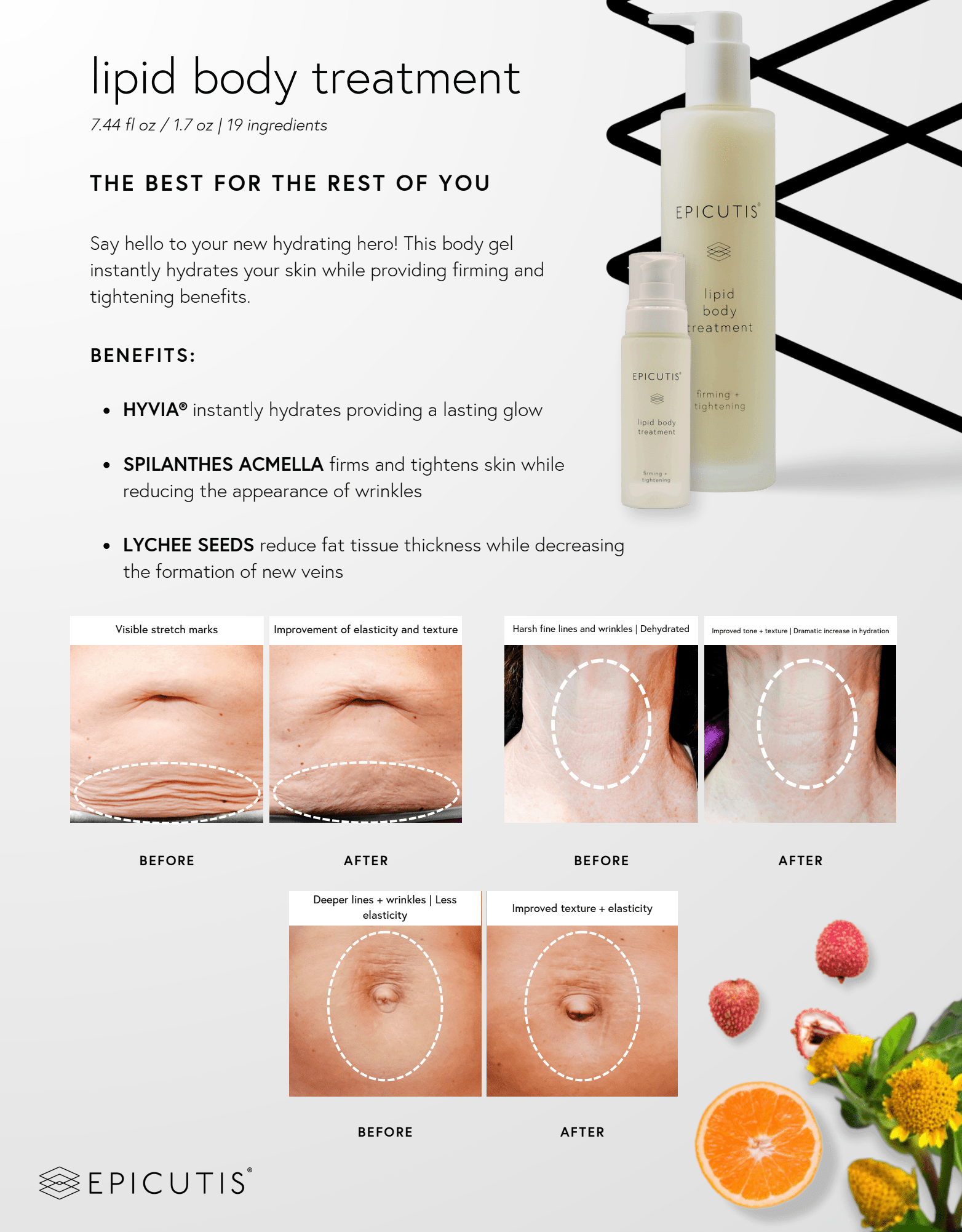 Epicutis Lipid Body Treatment TRAVEL by Epicutis at Beauty Culture MedSpa