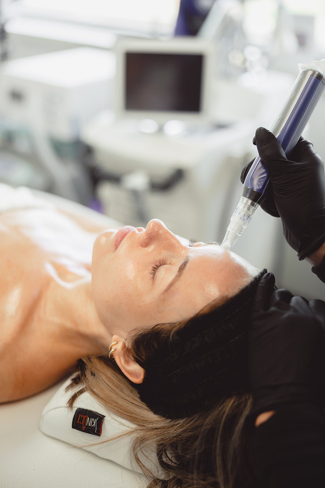 Microneedling by Beauty Culture MedSpa at Beauty Culture MedSpa