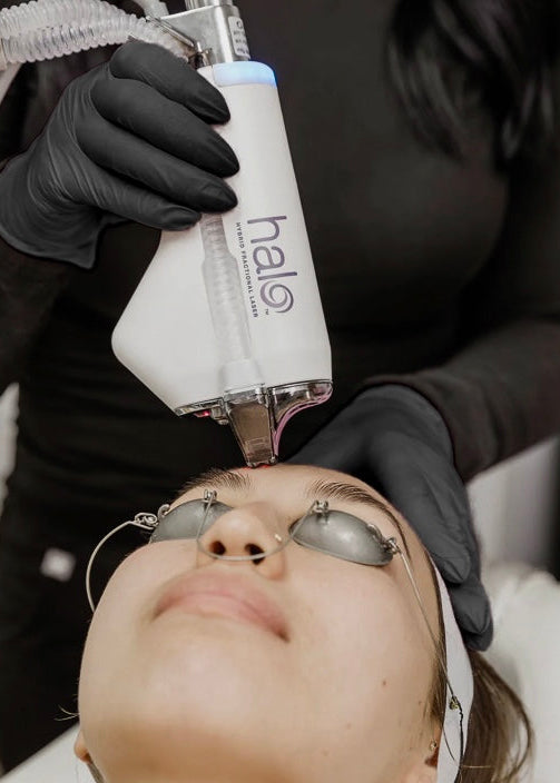 The Signature HALO™